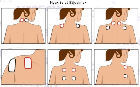 elektroda_felhelyezes__nyak_es_vall_.jpg